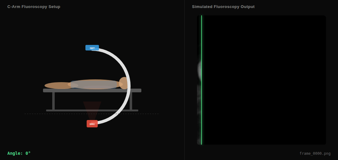C-Arm Fluoroscopy Simulation
